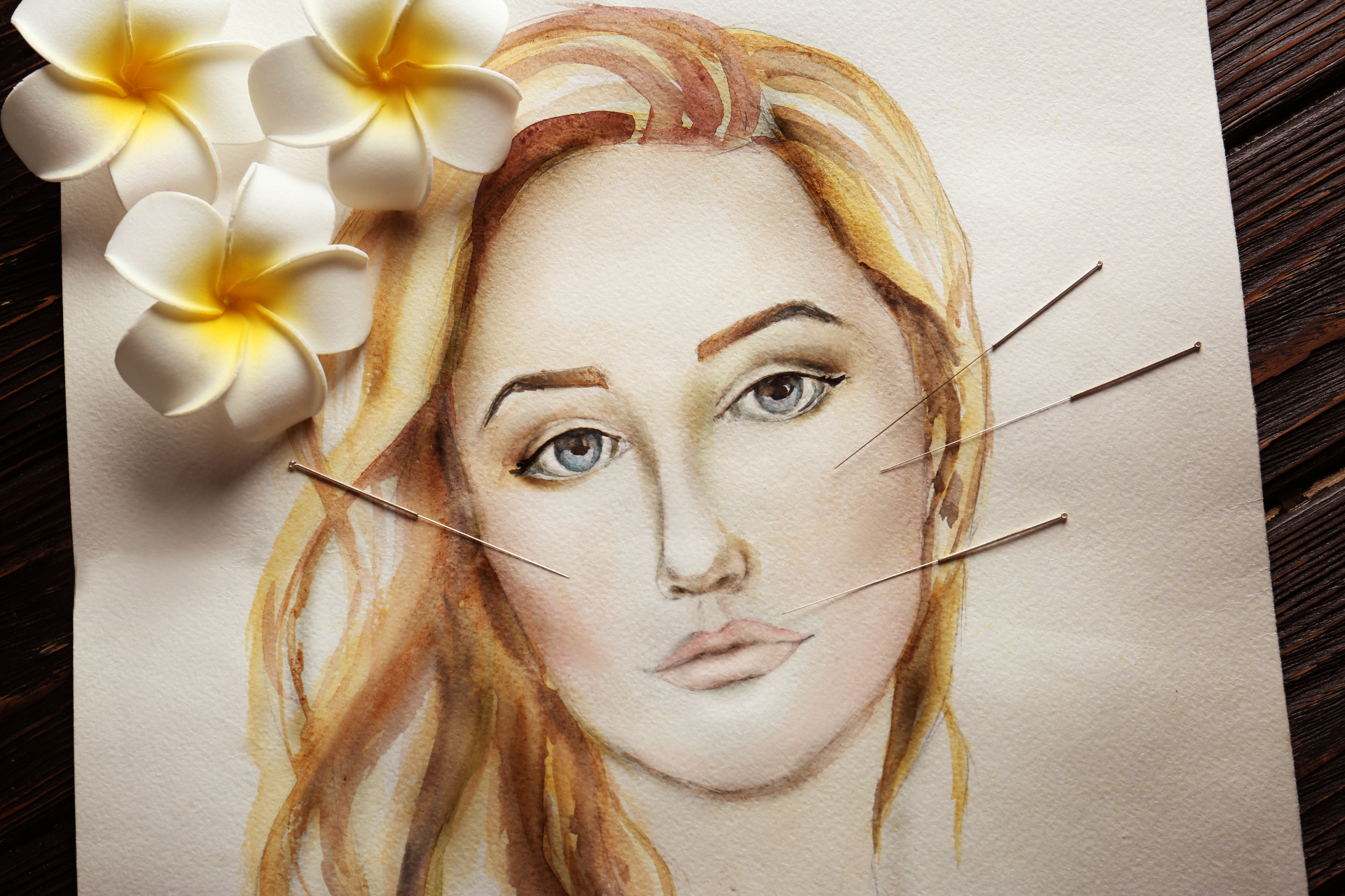 Cosmetic acupuncture illustration with flowers and needles