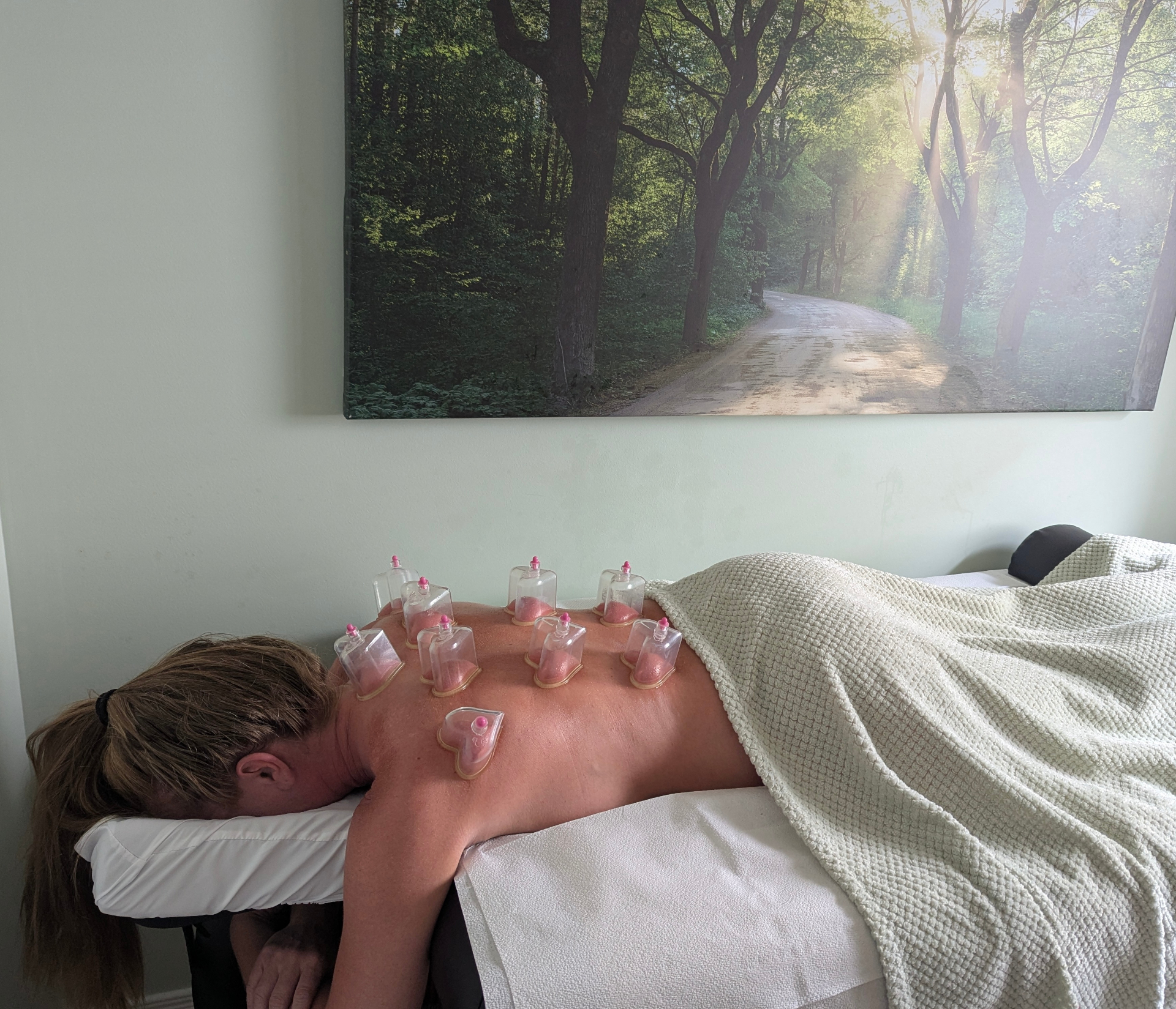 Cupping therapy session in treatment room